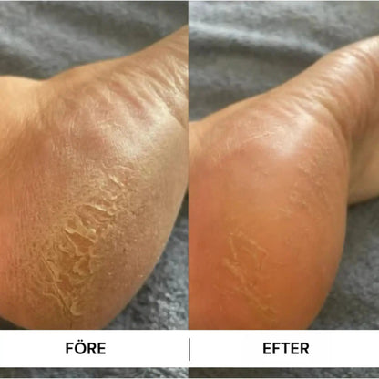 Mjukafötter™ reparerande fotkräm Mjukafötter