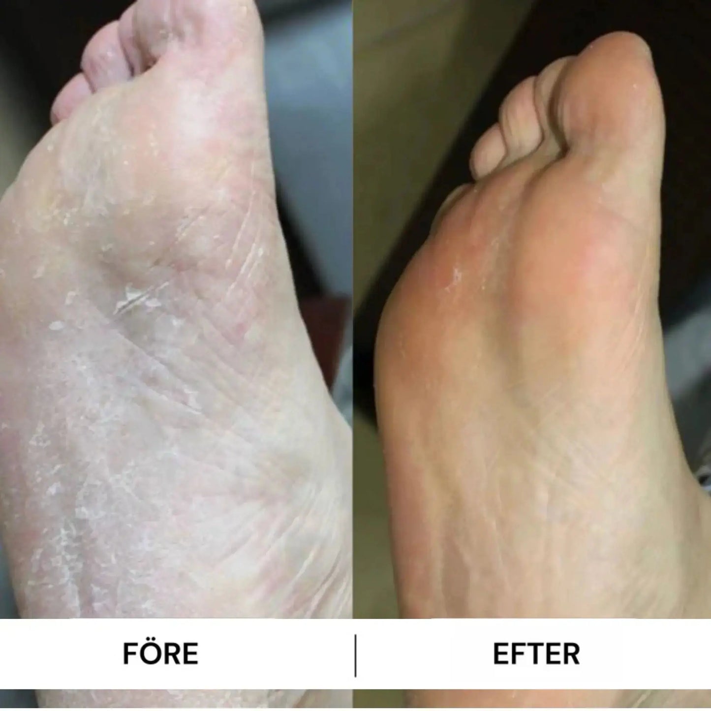 Mjukafötter™ reparerande fotkräm Mjukafötter