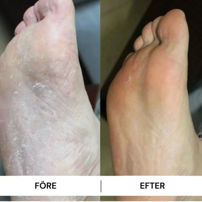 Mjukafötter™ reparerande fotkräm Mjukafötter