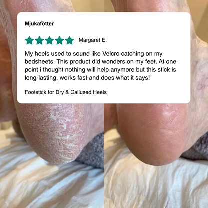 Footstick for Dry & Callused Heels